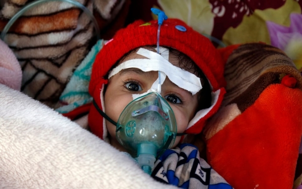 صحيفة بريطانية تدق ناقوس الخطر: الأطفال اليمنيون يواجهون حالياً أسوأ مستويات "سوء التغذية" منذ بداية الحرب