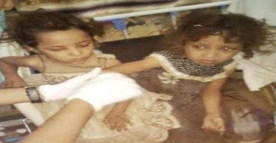 مليشيا الحوثي ترتكب جريمة بشعة بقتل طفلين واصابة شقيقتيهما ووالدهمافي حيس بالحديدة