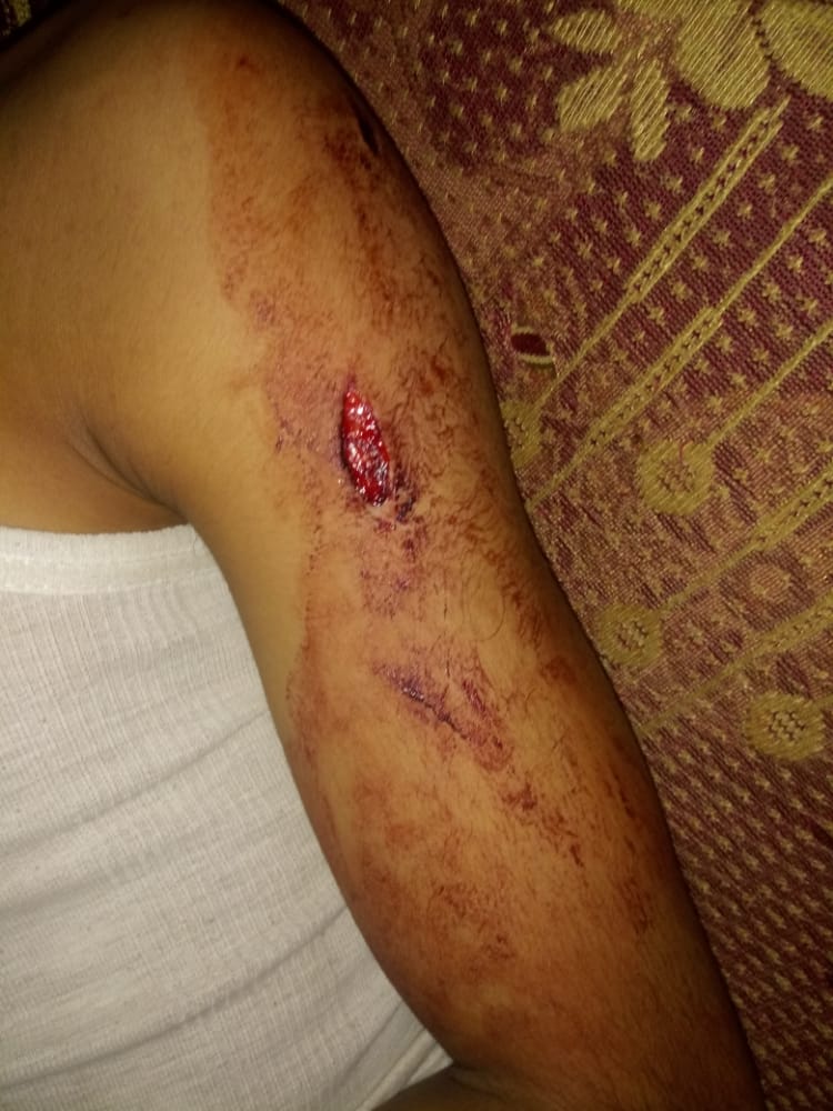 مدير «القضائية» يتعرض لعدة طعنات وسط صنعاء .. شاهد الصور 