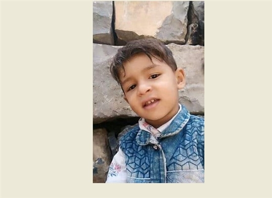 وفاة طفل متأثراً بالحصبة الألمانية التي انتشرت مؤخراً في محافظة حجة