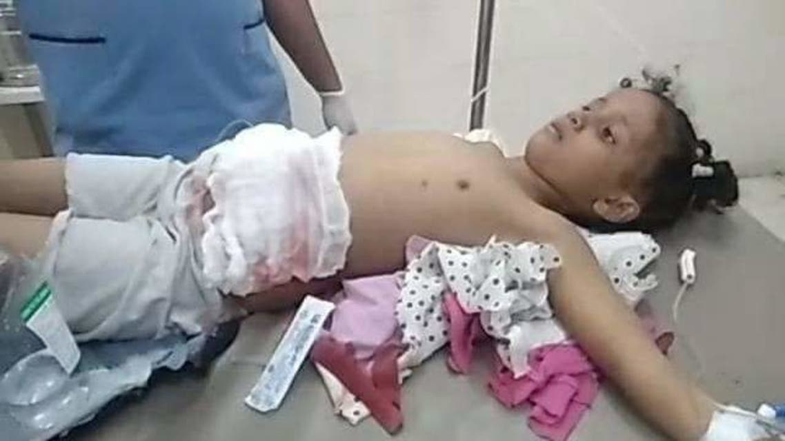 تعز.. رصاص قناص حوثي يختطف حياة طفلة بالخامسة من عمرها