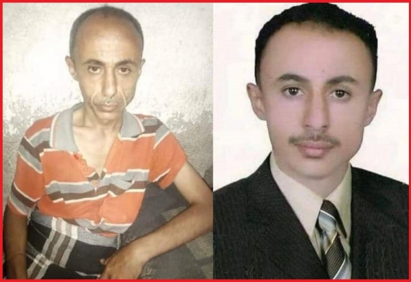 إب.. مليشيا الحوثي تطلق سراح صحفي بعد ان شارف على الموت جراء تعرضه للتعذيب الشديد(صورة)