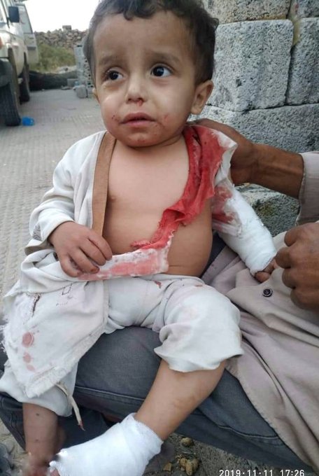 قذائف "الحوثيين" تقتل وتصيب 5 اطفال بتعز  