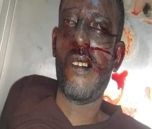 العثور على جثة "أبو عرب" في التواهي (صورة + تفاصيل)