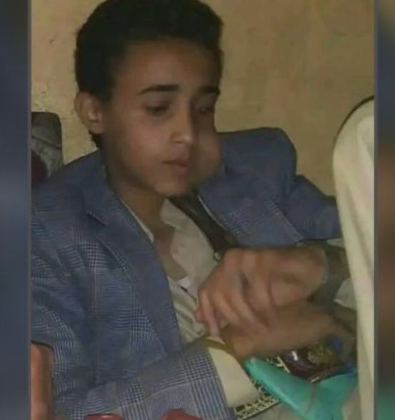 اختفاء غامض لطفل من خط المطار بصنعاء وأسرته تؤكد أنه "مخطوف"
