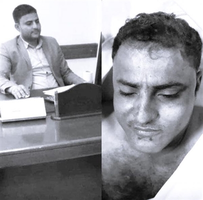 صنعاء .. وفاة أحد موظفي مستشفى جامعة العلوم بعد إستدراجه وتعذيبه حتى الموت