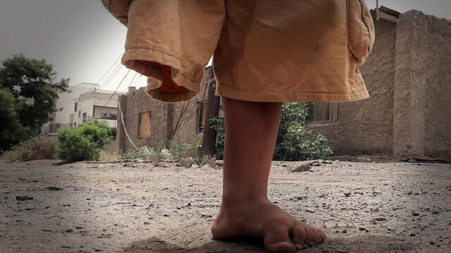 أرقام مخيفة .. إحصائية بضحايا الألغام الحوثية خلال 8 سنوات