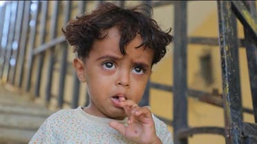 ساق مبتورة ومشهد قتل لن يُنسى.. مأساة طفل عمره 4 سنوات مع ألغام الحوثي