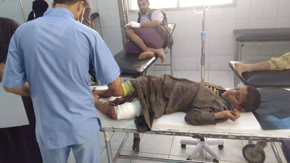 اصابة طفلين بانفجار لغم حوثي غربي مأرب.. صور