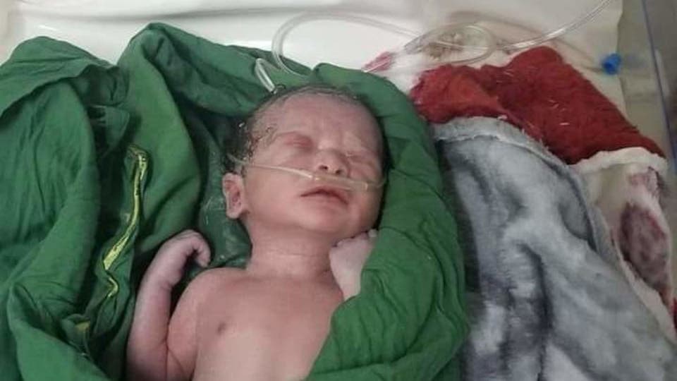 طالت والدته قذيفة حوثية.. إنقاذ جنين بعملية قيصرية