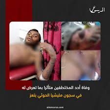 تعز .. وفاة مختطف متأثرا بالتعذيب الذي تعرض له في سجون الحوثي بعد أيام من الإفراج عنه