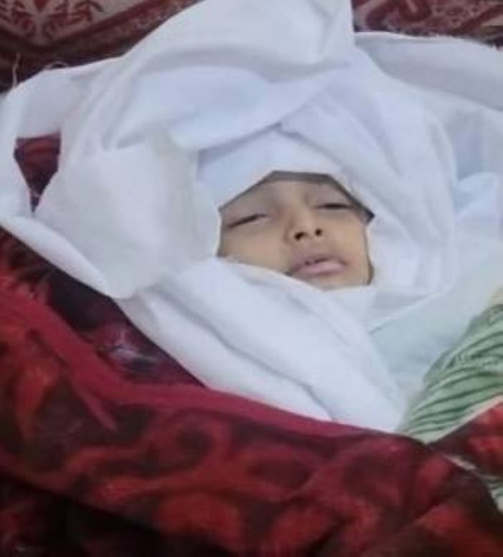 منظمات يمنية تطالب بمعاقبة الحوثي لتسميمه أطفال اليمن