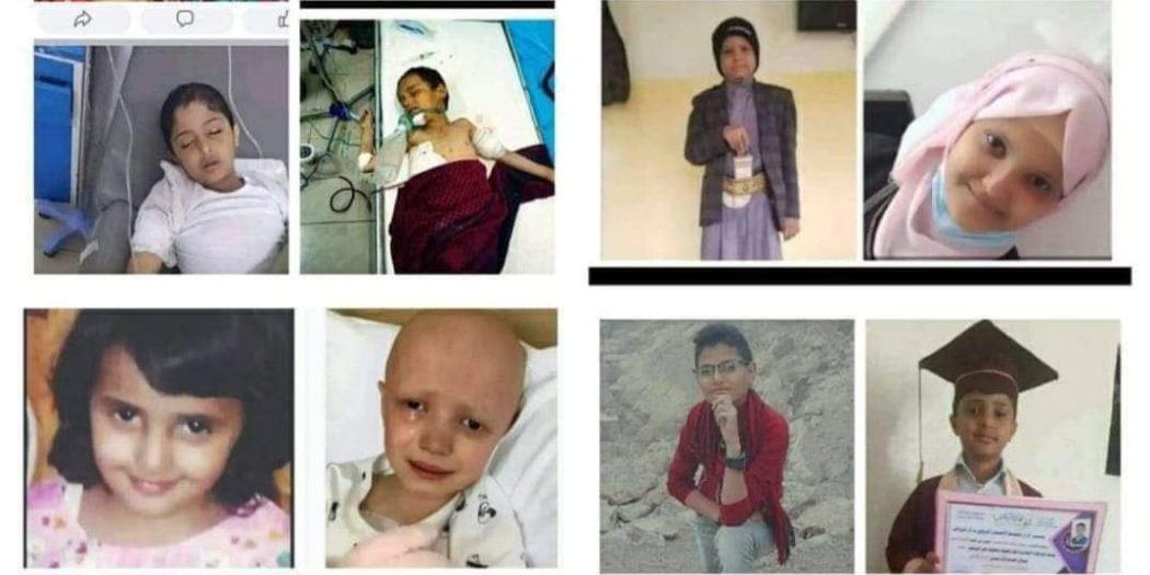 المليشيا تحاول دفن الأطفال المصابين بسرطان الدم لاخفاء جريمتها.