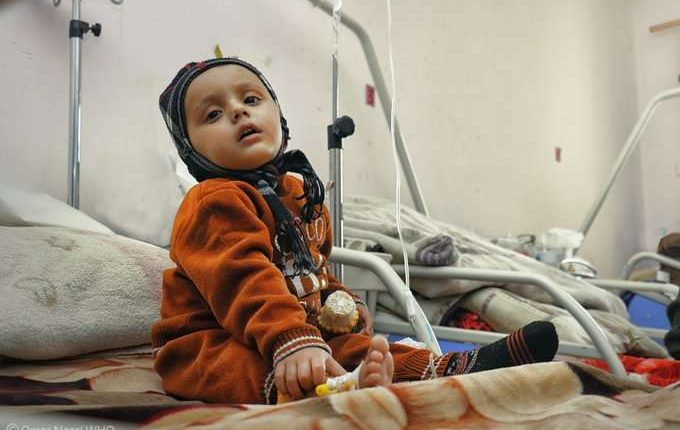 قريبًا.. انطلاق علاج مرضى السرطان بالإشعاع الذري لأول مرة في اليمن