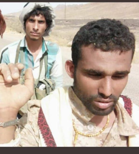 شاهد بالصورة: قائد مجاميع الحوثيين في «صرواح» أسيراً بيد قوات الجيش