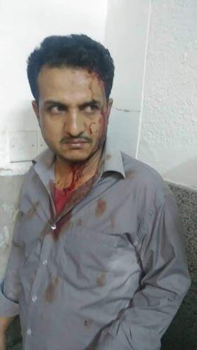 ضغوط حوثية لإجبار كوادر بمستشفى الثورة على تبرئة مشرف حوثي من الاعتداء عليهم