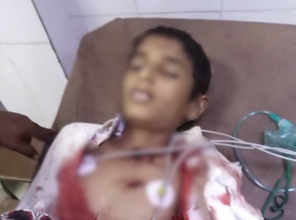جريمة تقشعر منها الأبدان .. مسلح حوثي يقتل طفلته بطريقة وحشية في محافظة حجه 