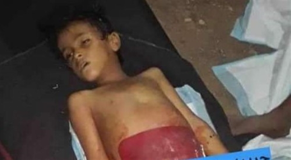 قتله بدم بارد .. قيادي حوثي يقتل طفلا في رداع بحجة إزعاجه أثناء النوم 
