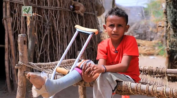 منظمة دولية: طفل واحد يُقتل أو يُصاب بالألغام كل يومين في اليمن