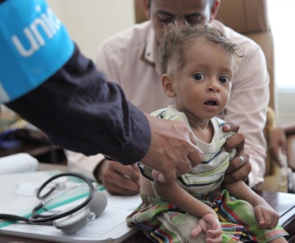 يونيسف: 49% من أطفال اليمن دون عمر الخامسة يعانون من سوء التغذية المزمن
