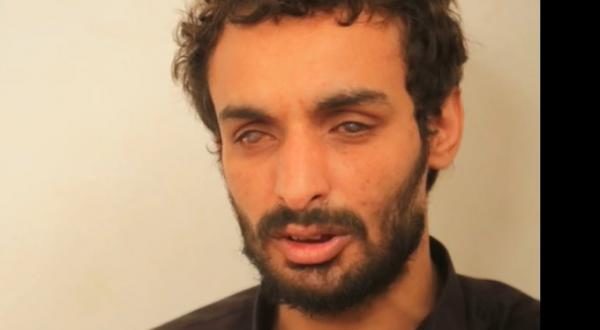 مليشيا الحوثي تعذب معتقل بطرق بشعة حتى فقد بصره “صورة”