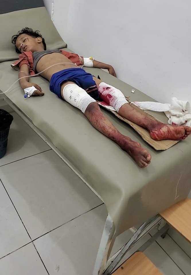 تعز.. وفاة الطفل سامي سهيم متأثرا بإصابته بقذيفة حوثية بعد ساعات من مقتل والده