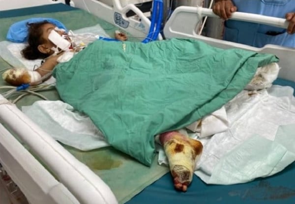 خلال أقل من شهر .. مرصد حقوقي يكشف عن مقتل وإصابة 13 مدنياً جراء الألغام الحوثية